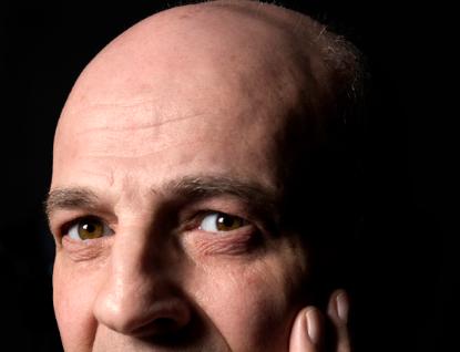 Balding man by Carl Batson