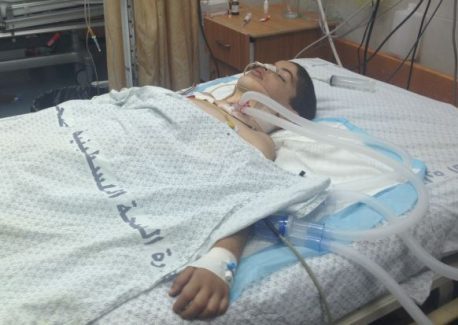 wounded boy, Gaza, by Kerry Anne Mendoza